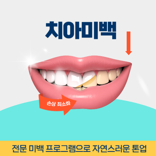 의왕치과 의왕시 치과 치아미백